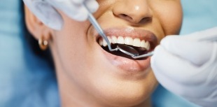 Diabetes and Dental Care