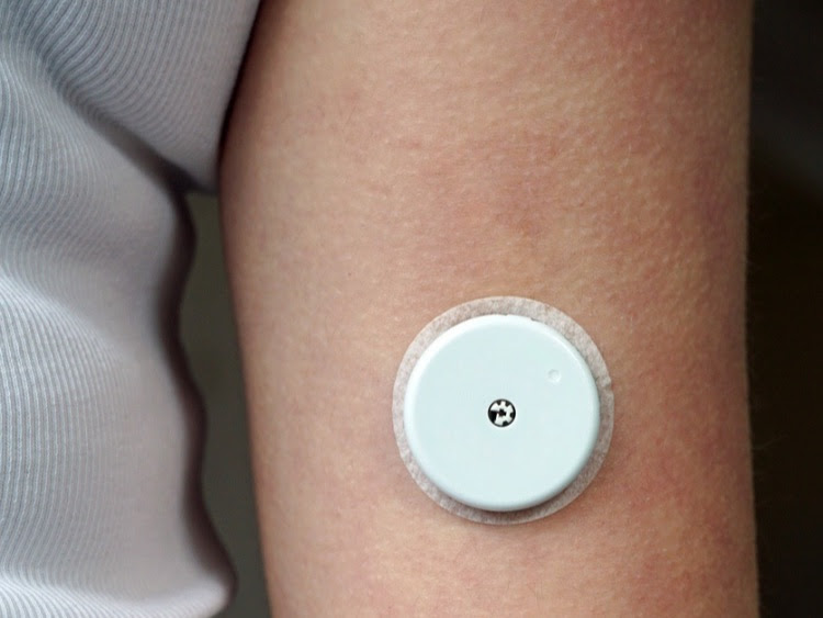 Continuous glucose monitoring is a valuable tool to manage diabetes