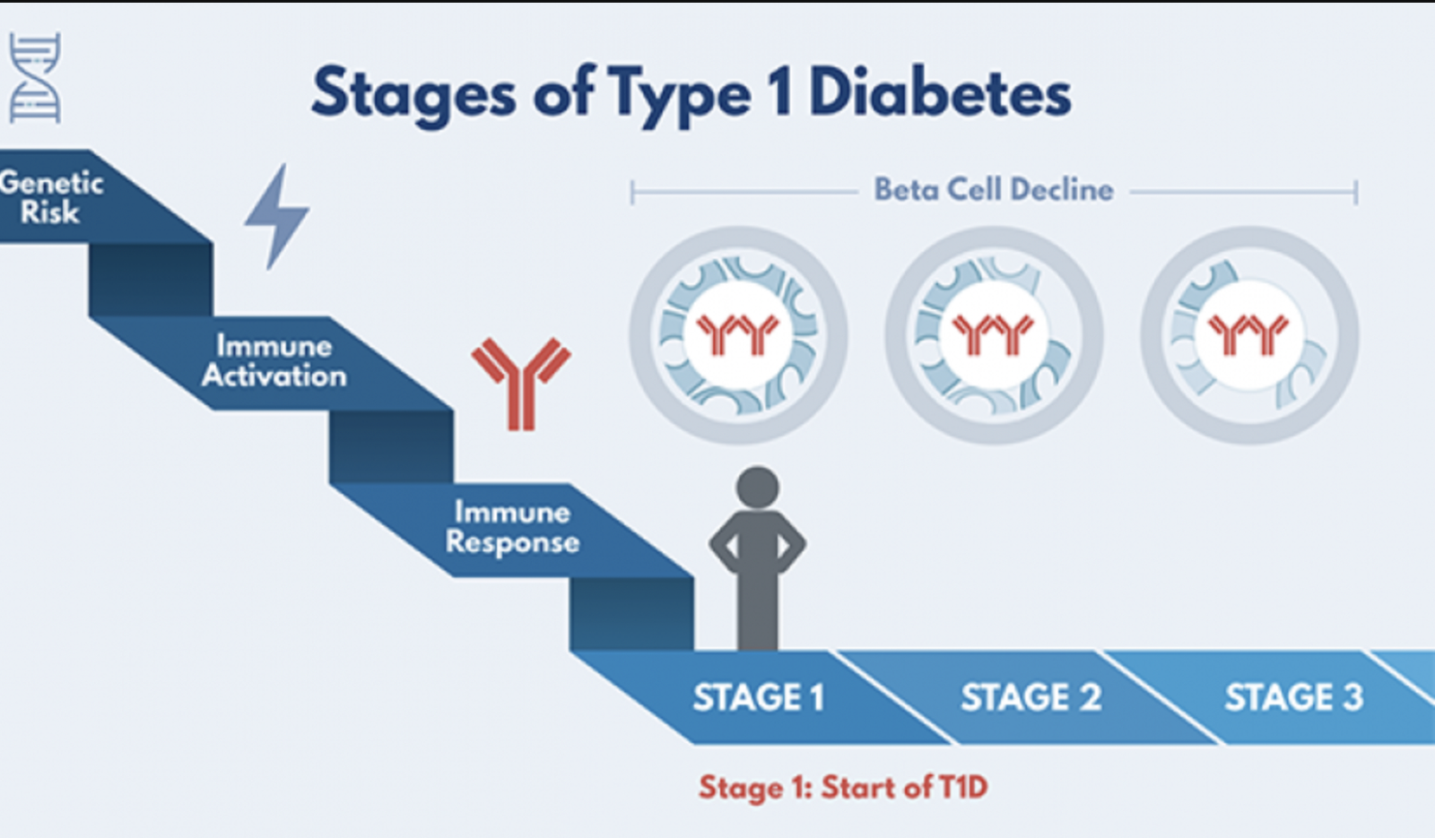 The stages of type 1 diabetes