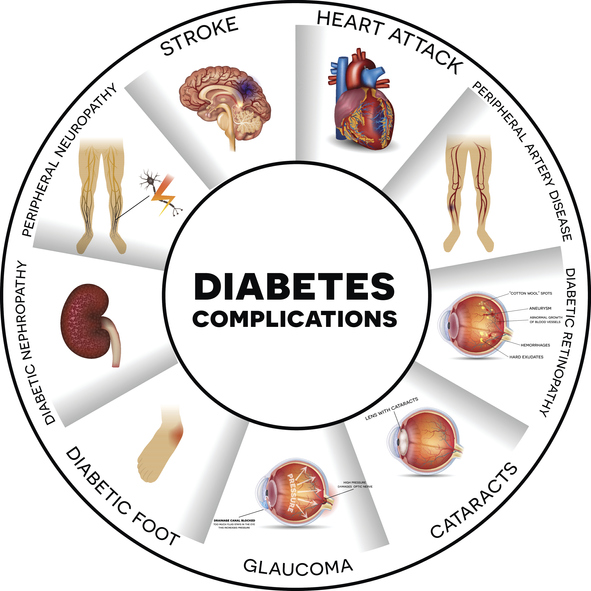 images of Complications caused by diabetes