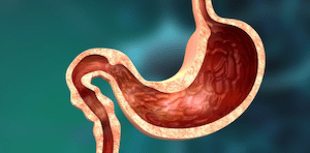 gut and small intestine type 2 diabetes