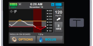 control-iq tandem diabetes