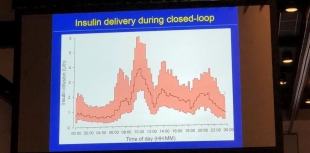 ADA 2018 diabetes news