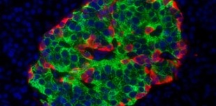 Microscopic view of islet cells in the pancreas