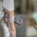 A person uses AID technology to manage their diabetes