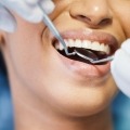Diabetes and Dental Care